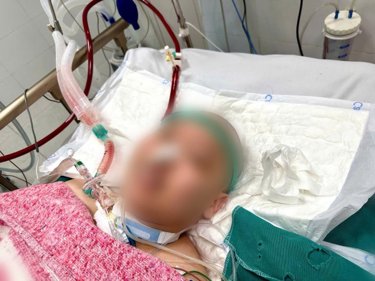 Bệnh nhân nặng được Bệnh viện Đức Giang cứu sống bằng phương pháp ECMO