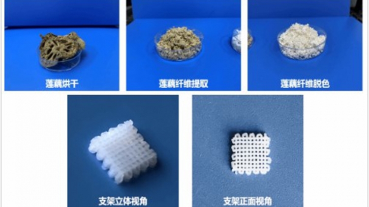 Trung Quốc đạt đột phá y học, dùng sợi ngó sen tái tạo xương 