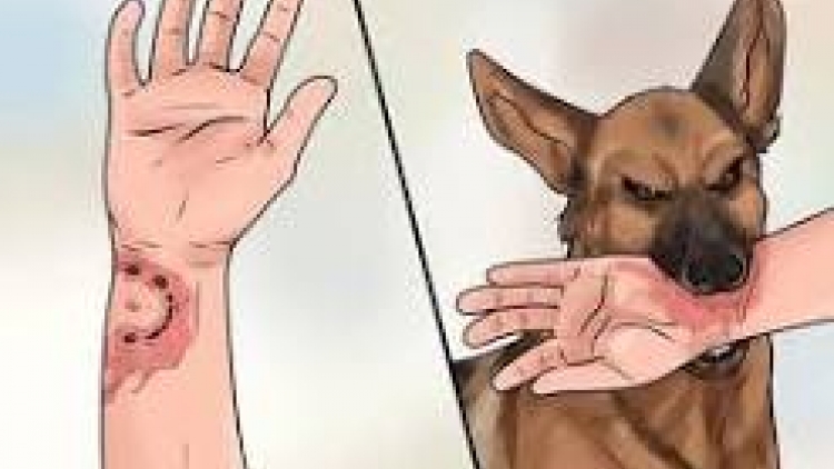 Bệnh viện Nhi Đồng TPHCM tiếp nhận nhiều ca trẻ bị chó cắn với thương tích nghiêm trọng