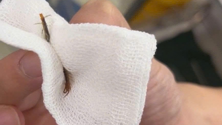 Hy hữu: lấy thành công con rết sống trong ống tai bệnh nhân 