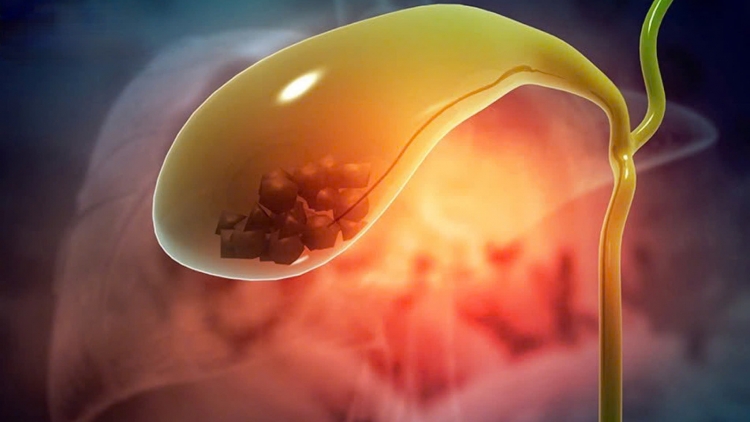 Giải rượu tại nhà bằng truyền dịch, nam thanh niên bị hôn mê