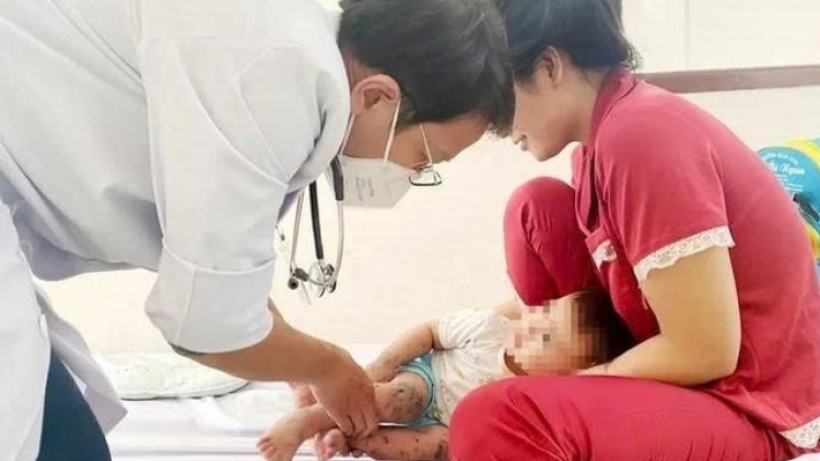 TP HCM: Chủng EV71 nguy hiểm tái xuất, số ca tay chân miệng tăng cao