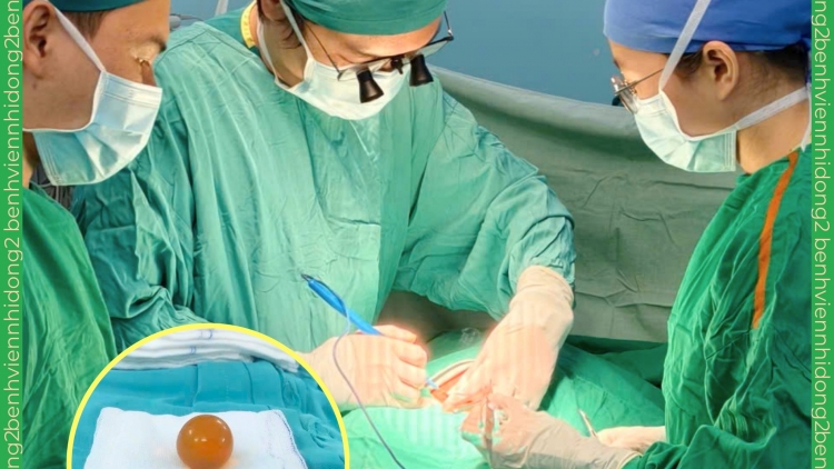 Bé gái 18 tháng bị tắc ruột nguy kịch vì nuốt hạt nở đồ chơi