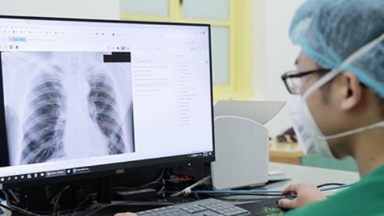 Bộ Y tế đề nghị thanh toán BHYT kỹ thuật điện quang không phụ thuộc vào thời gian chụp chiếu