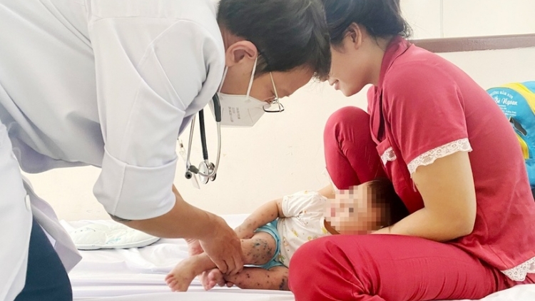 Ca tay chân miệng ở TP.HCM tăng cao