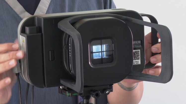 AI – chìa khóa mới cho cuộc chiến chống bệnh lao: Bước đột phá từ máy X-quang di động