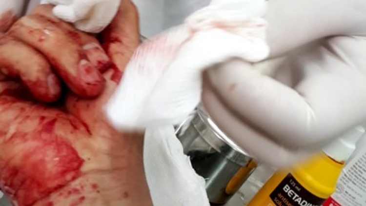 Báo Lao động họp báo thông tin chi tiết về vụ nhà báo Đỗ Doãn Hoàng bị 3 đối tượng lạ mặt dùng gậy đánh (Thời sự chiều 25/3/2016)
