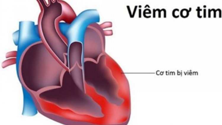 THỜI SỰ 18H CHIỀU 29/10/2019: Cục Y tế dự phòng khẳng định thông tin về loại vi rút gây viêm cơ tim dẫn đến tử vong là không chính xác.