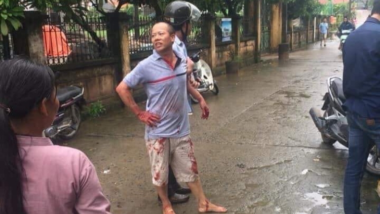 THỜI SỰ 18H00 CHIỀU 1/9/2019: Lực lượng công an khẩn trương điều tra vụ truy sát tại Hà Nội khiến 5 người trong một gia đình thương vong