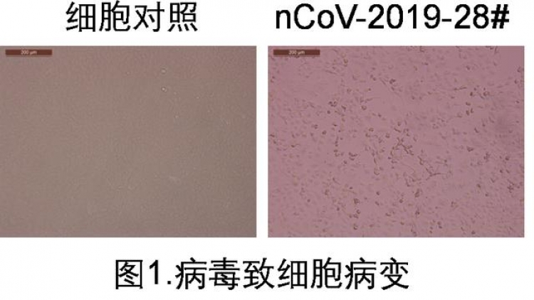 Trung Quốc phân lập được Covid 19 trong nước tiểu người bệnh (22/2/2020)