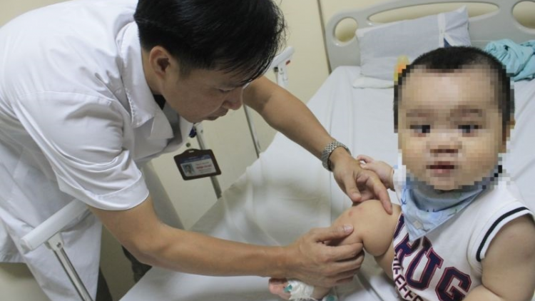 Nguy cơ bùng phát dịch tay chân miệng (19/7/2020)