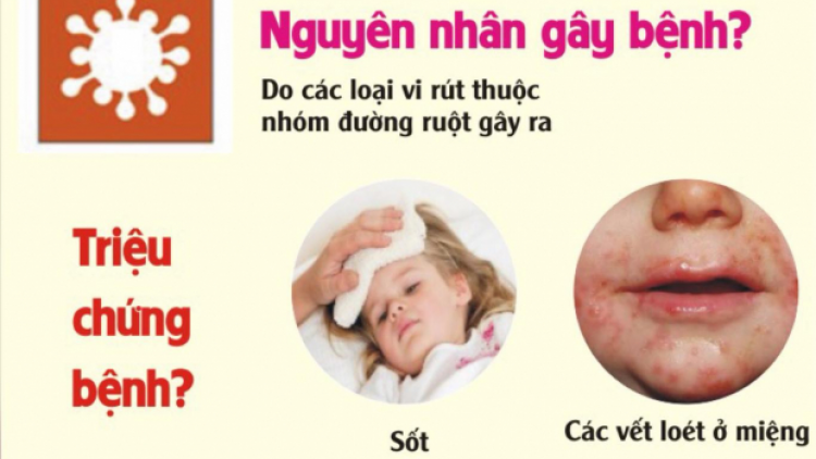 Phòng ngừa kiểm soát bệnh tay chân miệng 17/4/2021