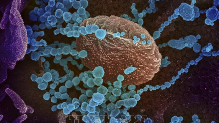 Chi-lê phát triển thiết bị đo nồng độ CO2 có thể cảnh báo nguy cơ lây lan dịch bệnh Covid-19 (27/6/2021)