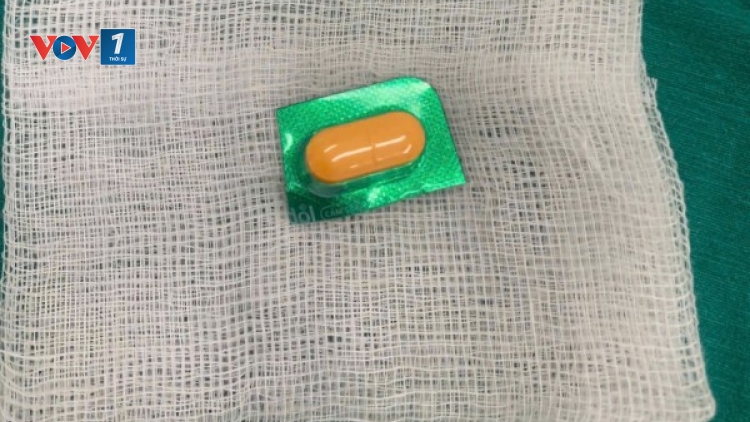 Gắp thành công di vật viên thuốc cả vỏ sắc nhọn ở thực quản bệnh nhân 33 tuổi (24/02/2025)