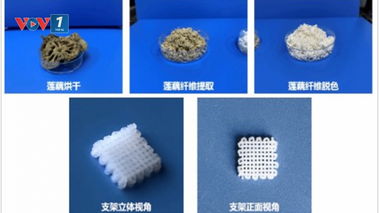 Trung Quốc đạt đột phá y học, dùng sợi ngó sen tái tạo xương