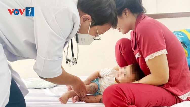 Ca tay chân miệng ở TP.HCM tăng cao