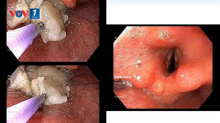 Xử trí thành công nhiều ca cấp cứu tình huống nguy hiểm
