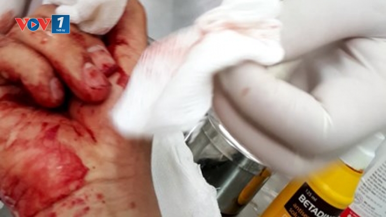 Báo Lao động họp báo thông tin chi tiết về vụ nhà báo Đỗ Doãn Hoàng bị 3 đối tượng lạ mặt dùng gậy đánh (Thời sự chiều 25/3/2016)
