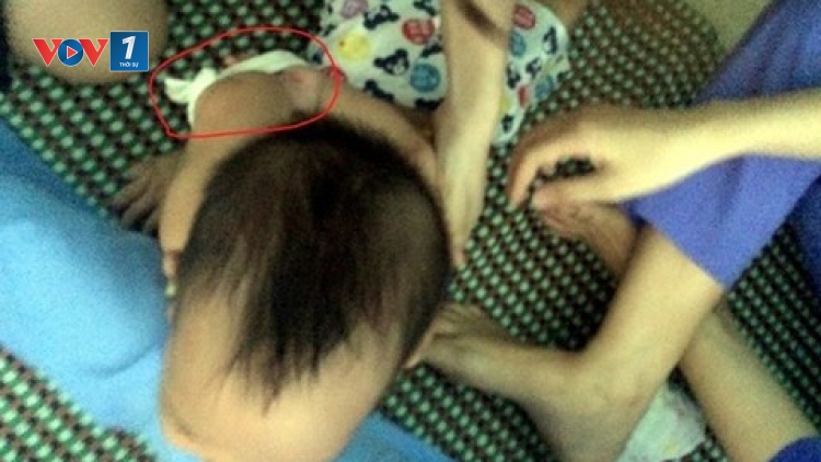 Cần nghiêm trị hành vi bạo hành trẻ mầm non