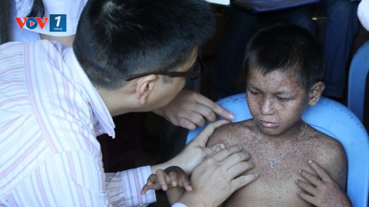 Thời sự đêm ngày 30/6/2015: Cục Y tế dự phòng (Bộ Y tế) nhận định, bệnh lạ ở Phú Thọ là bệnh khô da sắc tố.