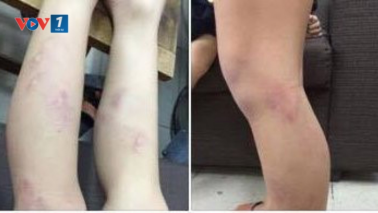 Chủ tịch Uỷ ban Nhân dân thành phố Hà Nội yêu cầu xử lý vụ học sinh lớp 2 bị giáo viên bạo hành tại trường Tiểu học Nguyễn Tri Phương, quận Ba Đình (Thời sự trưa 10/9/2017)