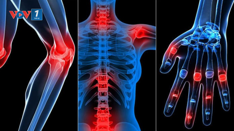 Tư vấn phòng ngừa, điều trị bệnh lý xương khớp trong cộng đồng (29/9/2020)