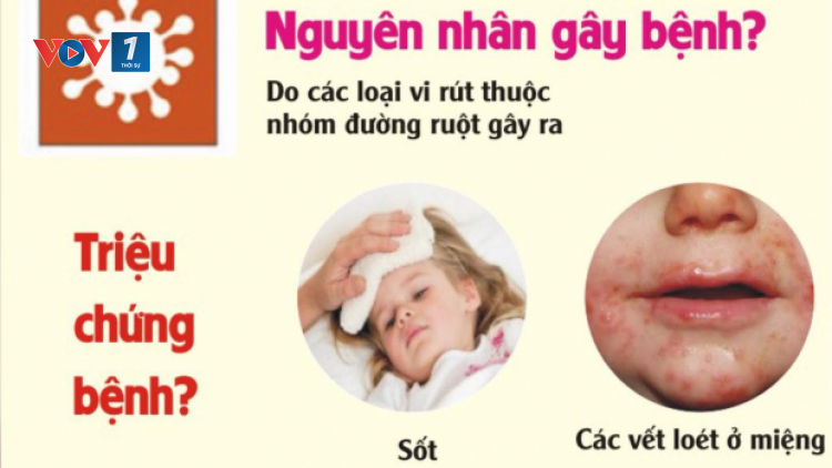 Phòng ngừa kiểm soát bệnh tay chân miệng 17/4/2021