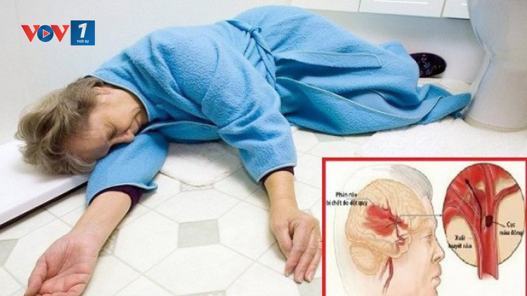 Khi bị bệnh đột quỵ cần chú ý gì? (23/3/2024)