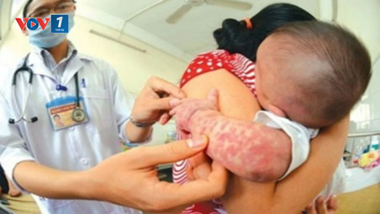 THỜI SỰ 12H TRƯA 12/07/2024: Bệnh sởi, ho gà diễn biến phức tạp