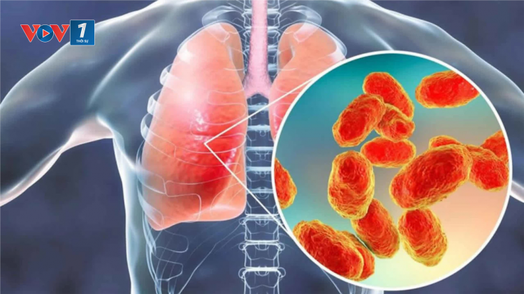 Thực hư virus gây viêm phổi đang lây lan ở Trung Quốc và giải pháp phòng ngừa (12/01/2025)