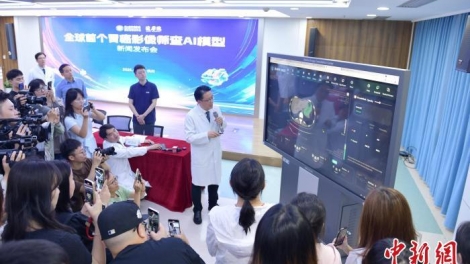 Trung Quốc ra mắt mô hình AI đầu tiên trên thế giới phát hiện sớm ung thư dạ dày bằng chụp CT