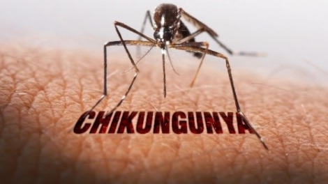 Dấu hiệu nhận biết bệnh chikungunya và giải pháp phòng ngừa
