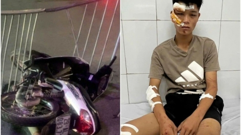 Thanh thiếu niên vi phạm pháp luật: Gia đình ở đâu khi con lạc lối?