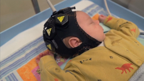 Anh thử nghiệm công nghệ giám sát hoạt động não bộ ở trẻ sơ sinh