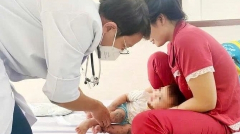 TP HCM: Chủng EV71 nguy hiểm tái xuất, số ca tay chân miệng tăng cao