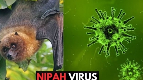 Bộ Y tế báo cáo Chính phủ về bệnh do vi rút Nipah