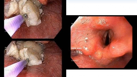 Xử trí thành công nhiều ca cấp cứu tình huống nguy hiểm 