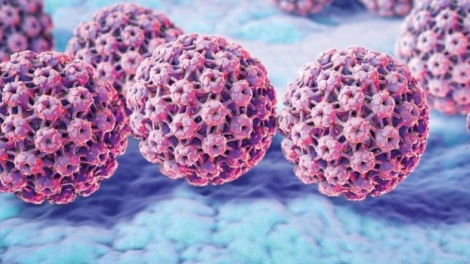 Cụ ông 70 tuổi bị sùi mào gà do quan hệ tình dục không an toàn