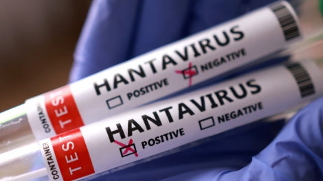 Châu Âu khẩn cấp sơ tán hành khách khỏi tàu du lịch có virus Hanta