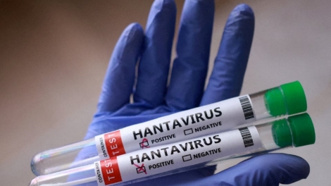 Truy lùng dấu vết Hantavirus: Các nhà khoa học bắt giữ những con chuột đầu tiên 