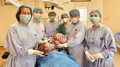 Nữ sinh 16 tuổi được phẫu thuật thành công khối u  gần 15 kg