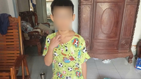 Công an làm việc với người cha nghi bạo hành con trai 8 tuổi ở TP.HCM