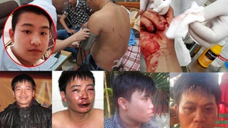 Cần có cơ chế để bảo vệ nhà báo trong quá trình tác nghiệp (30/3/2016)