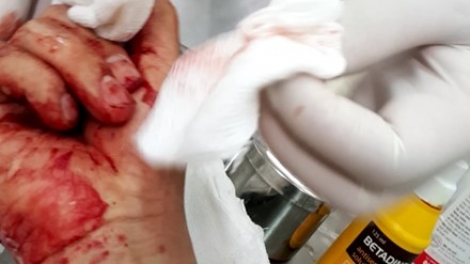 Báo Lao động họp báo thông tin chi tiết về vụ nhà báo Đỗ Doãn Hoàng bị 3 đối tượng lạ mặt dùng gậy đánh (Thời sự chiều 25/3/2016)