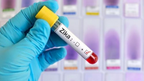 Thành phố Hồ Chí Minh ghi nhận thêm 12 ca nhiễm virus Zika mới. (Thời sự chiều 31/10/2016)