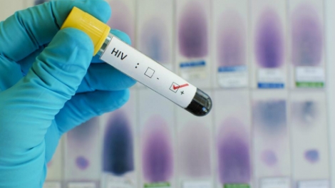 Châu Phi bắt đầu tiêm thử nghiệm loại vắc xin HIV mới, mang lại hy vọng sớm tìm ra các biện pháp tốt hơn và hiệu quả hơn trong phòng chống virus lây truyền đại dịch AIDS (Thời sự chiều 4/12/2017)