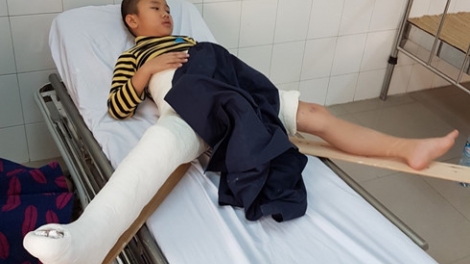 18 giáo viên Trường Tiểu học Nam Trung Yên ở Hà Nội vừa tố cáo Hiệu trưởng thông tin sai lệch về việc học sinh gãy chân trong sân trường (Thời sự trưa 19/2/2017)