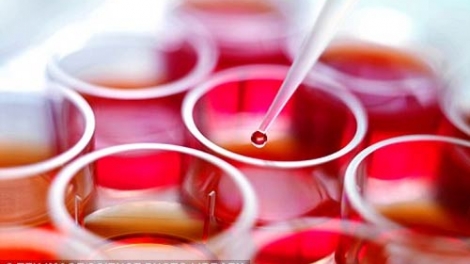 Điều trị các bệnh lý về máu nhờ ghép tế bào gốc tạo máu (30/6/2017)