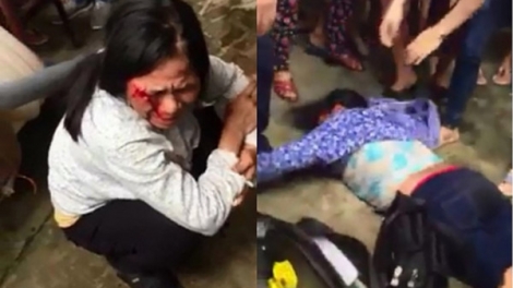 Hội chứng đám đông, coi thường pháp luật và hành xử theo lối tự phát đang có chiều hướng gia tăng (24/7/2017)