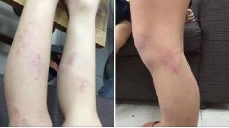 Chủ tịch Uỷ ban Nhân dân thành phố Hà Nội yêu cầu xử lý vụ học sinh lớp 2 bị giáo viên bạo hành tại trường Tiểu học Nguyễn Tri Phương, quận Ba Đình (Thời sự trưa 10/9/2017)